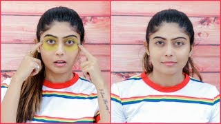 7 AMAZING DARK CIRCLES amp SKIN WHITENING HACKS  Rinkal Soni [upl. by Ennaeirrac]