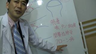 「肺癌とバチ指」【吉田たかよし】９０秒でわかる 医学解説その12 [upl. by Ennairol]