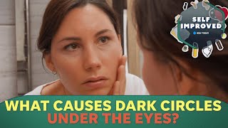 A Dermatologist reveals why you get dark circles under your eyes  SELF IMPROVED [upl. by Hceicjow]