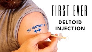 First Ever Deltoid Injection Testosterone Replacement Therapy [upl. by Airotkiv]