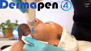 DermaPen Microneedling Anti aging Meso Glide treatment with a male first time Dermapen client [upl. by Billy]