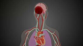 Atrial Fibrillation Overview  ECG types pathophysiology treatment complications [upl. by Pyszka]