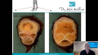 Fesselträger des Pferdes Diagnose  Therapie  Prognose [upl. by Onilegna]