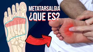 🦶🏻 Que es la METATARSALGIA causas sintomas y tratamiento [upl. by Mildred]