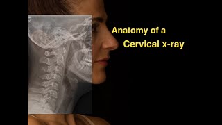 Anatomy of a Cervical xray [upl. by Bernadene187]