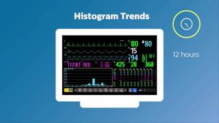 Empowerment Visualizing critical patient information in the ICU [upl. by Dillon386]