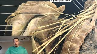 Brachial Plexus EXPLAINED Using a Cadaver [upl. by Neelac470]