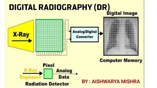 DIGITAL RADIOGRAPHY DR PART1  BY AISHWARYA MISHRA [upl. by Kralc]