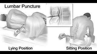 Mnemonics to remember structures pierced during Lumbar Puncture [upl. by Nuahsyt]