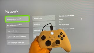 Xbox Series XS How to Fix Xbox Network Disconnecting Tutorial Boost Internet Speeds amp Reduce Lag [upl. by Sandon]