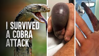 How to Survive a King Cobra Attack [upl. by Tildie107]