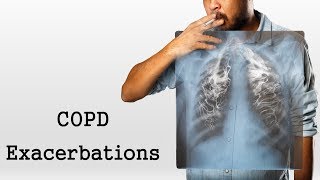 COPD Exacerbations [upl. by Krissy]