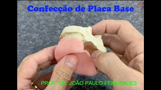 8  Confecção de placa base para Prótese Total [upl. by Janicki]