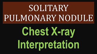 Chest Radiography NonSmall Cell Lung Cancer [upl. by Rees]