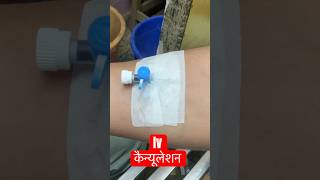 intravenous cannulation ivcannulation medicalequipment SMpharmacy subscribe [upl. by Eziechiele374]