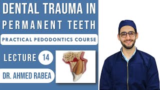 Lecture 14  Management of Traumatic Dental Injuries in PERMANENT Teeth  كورس بيدو عملي [upl. by Gahan600]