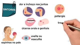 Behcets syndromeBehcet Disease  Etiology Pathogenesis Clinical features Diagnosis amp Treatment [upl. by Ahon289]