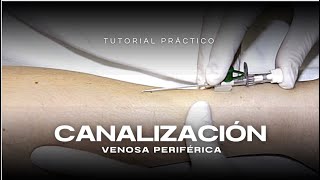 CANALIZACIÓN VENOSA  TUTORIAL PRÁCTICO [upl. by Anelhtak]