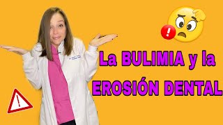 La Bulímia y La Erosión Dental 61 [upl. by Tugman]