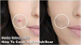 how to COVER UP FACIAL SCARS WITH MAKEUP woah [upl. by Euqinna]