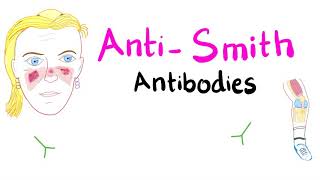 AntiSmith antiSm Antibodies Systemic Lupus Erythematosus [upl. by Chere530]