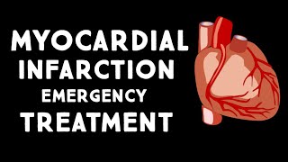 Myocardial Infarction MIHeart Attack Treatment in Emergency  Step wise STEMI Management USMLE [upl. by Nylarej]