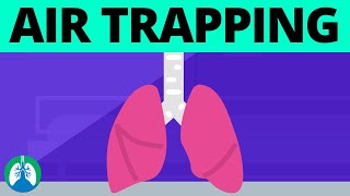 Air Trapping PFT Results TMC Practice Question  Respiratory Therapy Zone [upl. by Malilliw]