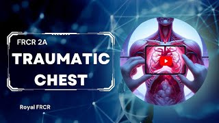 17  Chest Imaging for FRCR [upl. by Llekim]