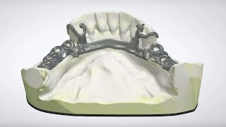 3Shape Dental System  RPD Design [upl. by Lanie]