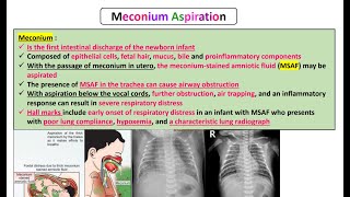 Meconium Aspiration [upl. by Riti]