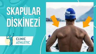 Skapular Diskinezi Nedir [upl. by Jo]