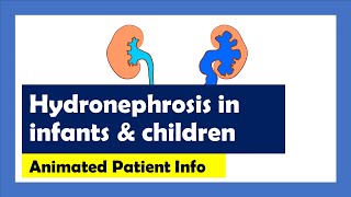 Hydronephrosis Explained Animated Patient Info [upl. by Gypsy]