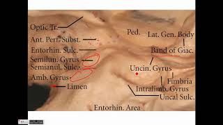 Neurosurgery Temporal lobe anatomy and its implications in temporal lobe epilepsy [upl. by Gunzburg]