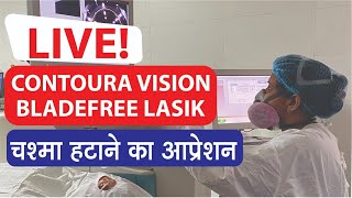 LIVE Surgery  CONTOURA VISION Bladefree Lasik  CLIO Eye Care [upl. by Yrag837]