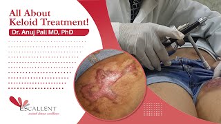 Keloid Treatment  Injection Triamcinolone  Cryotherapy  Dr Anuj Pall MD PhD [upl. by Georges]