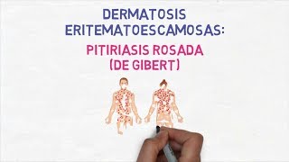 Dermatología  Pitiriasis Rosada de Gibert o de Gilbert [upl. by Nodarb]