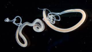 Trichuris vulpis whipworm [upl. by Noiztneb526]