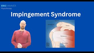 Impingement Syndrome [upl. by Zimmerman843]