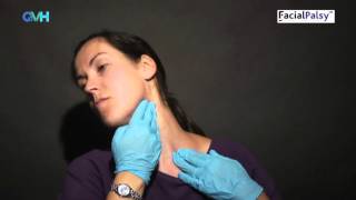 Facial Palsy DVD 2  Management of Synkinesis  Stretches for the Tight Side [upl. by Joanne]