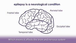 What is epilepsy  Epilepsy Society [upl. by Alviani]