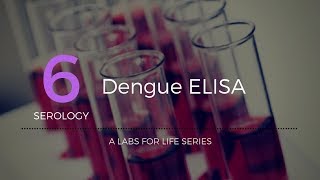 Dengue ELISA [upl. by Ecirehs88]