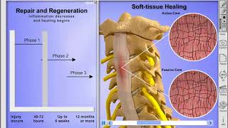 Ligament Healing [upl. by Idarb]