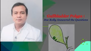 How to Manage Gallbladder Polyps Doc Rolly Answered the Questions [upl. by Rovert535]