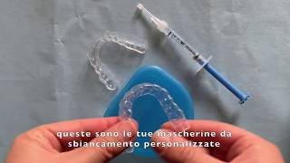 Come fare lo SBIANCAMENTO DENTALE DOMICILIARE [upl. by Beore]