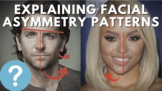 Why You Have An Asymmetrical Face  The Right TMCC Pattern [upl. by Alleacim]