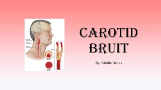 Carotid bruit  causes pathophysiology sign value [upl. by Steffi]