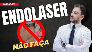 NÃO faça ENDOLASER [upl. by Alarise]