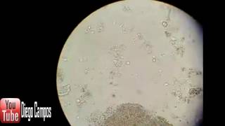 Trichomonas hominis  Coproanalisis [upl. by Shah]