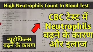 High NeutrophilsNeutrophils high in blood testNeutrophils in hindiNeutrophils low in blood test [upl. by Acimak]