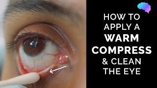 How To Get WHITER EYES  6 Steps To Make Eyes Clear Bright amp White  Chris Gibson [upl. by Akiehsal374]